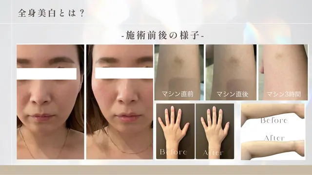 ロイヤルホワイトニング銀座 加盟説明資料 3枚目